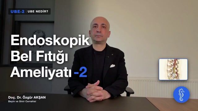 UBE Nedir?